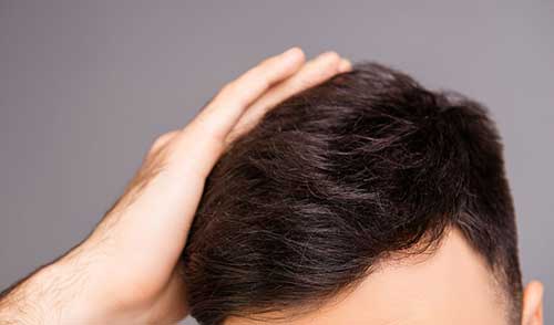 如何养发护发，9个方法护理好头发